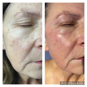 Божена Дорощук, Ровно Фото - 3