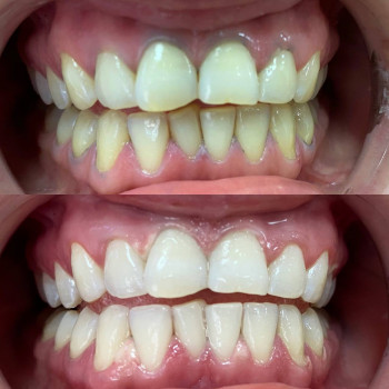 Smile Bar, Київ Фото - 3