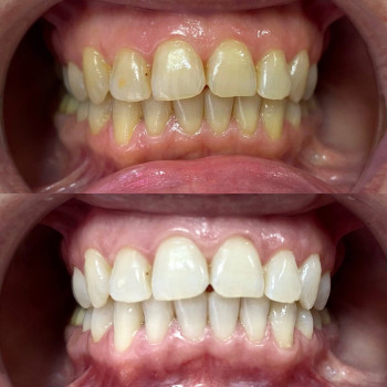 Smile Bar, Київ Фото - 5