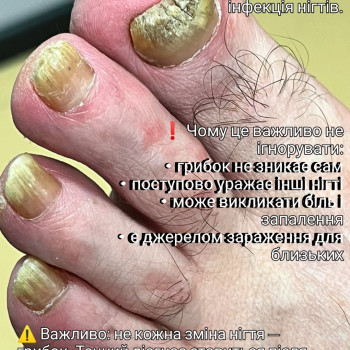 Фото з портфоліо фахівця Олена Шибанова (подолог, Черкаси)