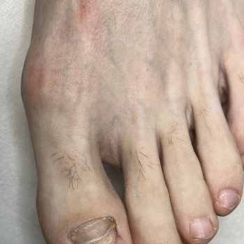 Фото з портфоліо фахівця Олена Шибанова (подолог, Черкаси)