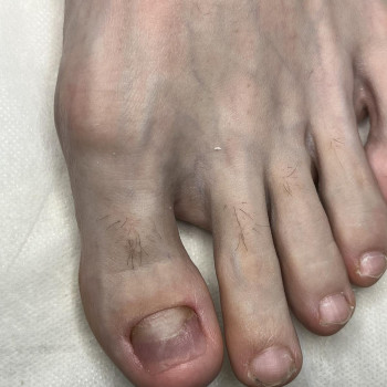 Фото з портфоліо фахівця Олена Шибанова (подолог, Черкаси)