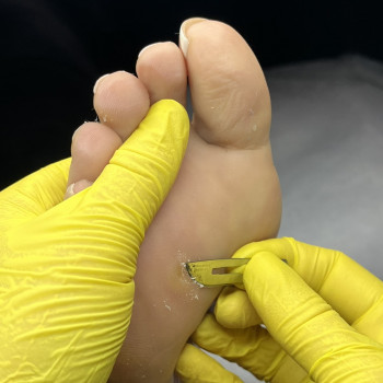 Фото з портфоліо фахівця Олена Шибанова (подолог, Черкаси)