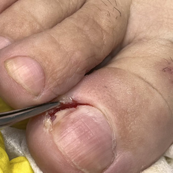 Фото з портфоліо фахівця Олена Шибанова (подолог, Черкаси)