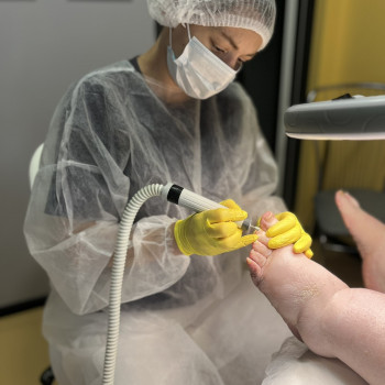 Фото з портфоліо фахівця Олена Шибанова (подолог, Черкаси)