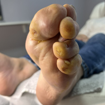 Фото з портфоліо фахівця Олена Шибанова (подолог, Черкаси)