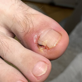 Фото з портфоліо фахівця Олена Шибанова (подолог, Черкаси)