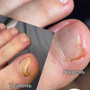 Фото з портфоліо фахівця Олена Шибанова (подолог, Черкаси)