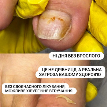 Фото з портфоліо фахівця Олена Шибанова (подолог, Черкаси)