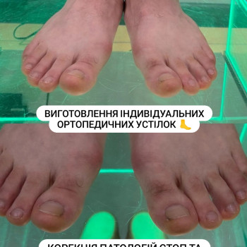 Фото з портфоліо фахівця Олена Шибанова (подолог, Черкаси)