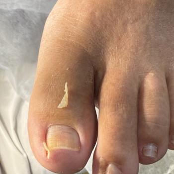 Фото з портфоліо фахівця Олена Шибанова (подолог, Черкаси)