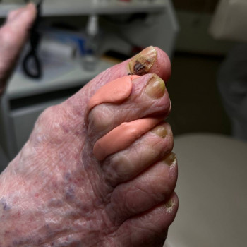 Фото з портфоліо фахівця Олена Шибанова (подолог, Черкаси)