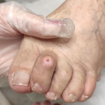 Фото з портфоліо фахівця Олена Шибанова (подолог, Черкаси)