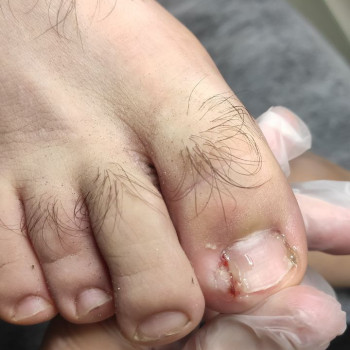 Фото з портфоліо фахівця Олена Шибанова (подолог, Черкаси)