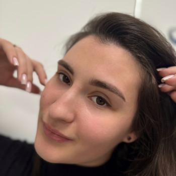 Заживші брови