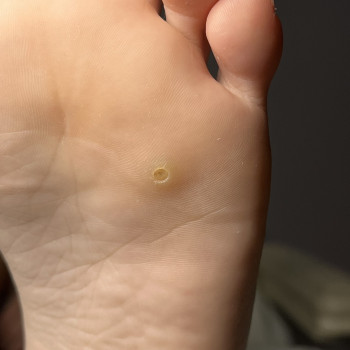 Фото з портфоліо фахівця Олена Шибанова (подолог, Черкаси)