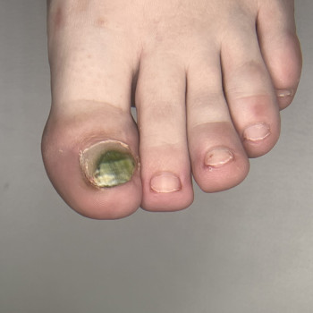 Фото з портфоліо фахівця Олена Шибанова (подолог, Черкаси)