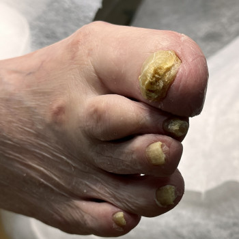 Фото з портфоліо фахівця Олена Шибанова (подолог, Черкаси)