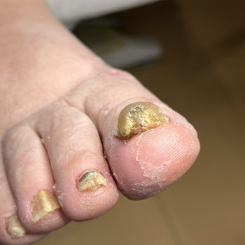 Фото з портфоліо фахівця Олена Шибанова (подолог, Черкаси)