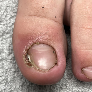 Фото з портфоліо фахівця Олена Шибанова (подолог, Черкаси)