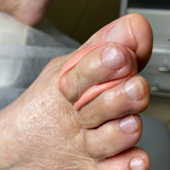 Фото з портфоліо фахівця Олена Шибанова (подолог, Черкаси)