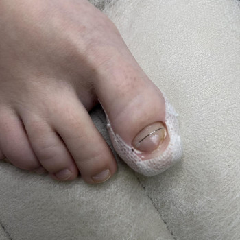 Фото з портфоліо фахівця Олена Шибанова (подолог, Черкаси)