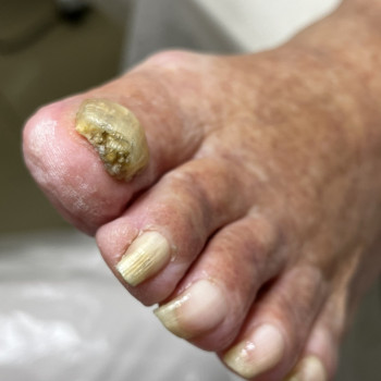 Фото з портфоліо фахівця Олена Шибанова (подолог, Черкаси)