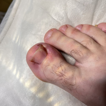 Фото з портфоліо фахівця Олена Шибанова (подолог, Черкаси)