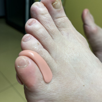 Фото з портфоліо фахівця Олена Шибанова (подолог, Черкаси)