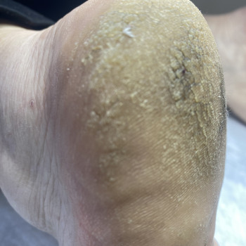 Ольга Живець, Чернігів Фото - 37