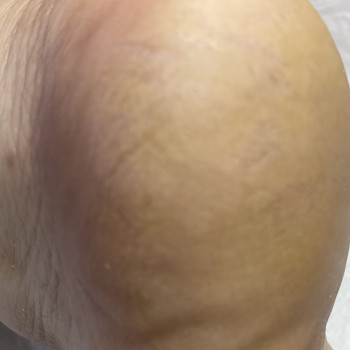 Ольга Живець, Чернігів Фото - 38