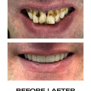 Стоматологія Н+, Кам'янське Фото - 5