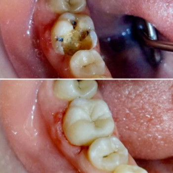 Семейная Стоматология, Каменское Фото - 5