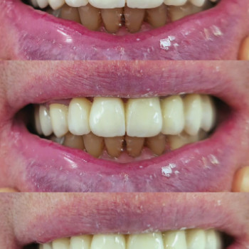 Stogniy, Кам'янське Фото - 5