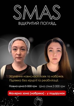 LFS - Київська