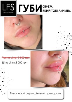 LFS - Київська