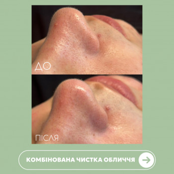 Ірина Кочерга, Черкаси Фото - 4