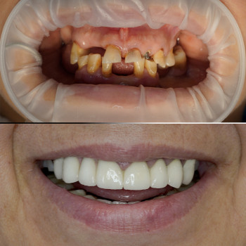 Твій стоматолог, Київ Фото - 1