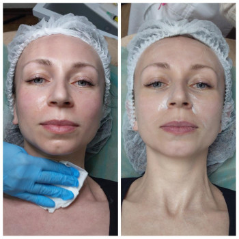 Полінуклеотиди