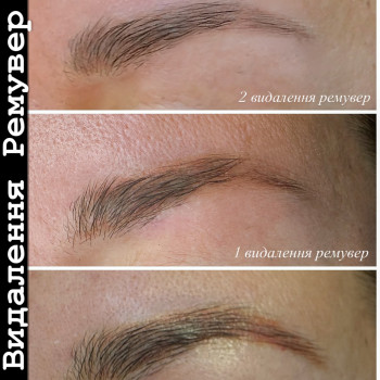 Удаление перманента / татуажа
                    Мастер перманентного макияжа Алиса Днепр