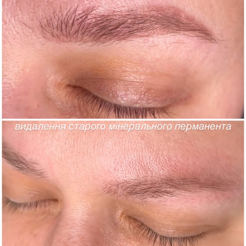 Удаление перманента / татуажа
                    Мастер перманентного макияжа Алиса Днепр