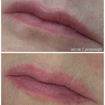 Удаление перманента / татуажа
                    Мастер перманентного макияжа Алиса Днепр