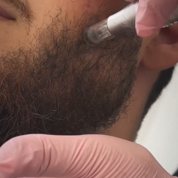 Мезо чоловічої бороди, фото - майстер перманентного макіяжу Аліса Шаргородська