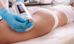  Мастер шугаринга  Днепр