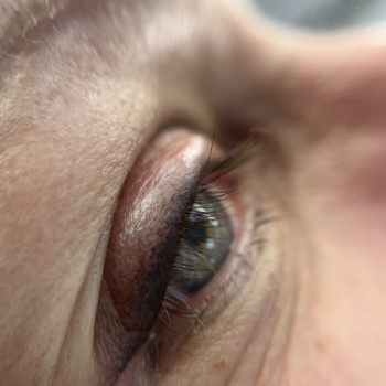 Наталія Семенцова, Чернигов Фото - 7