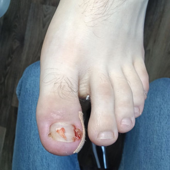 Оксана Дегтеренко, Чернигов Фото - 4