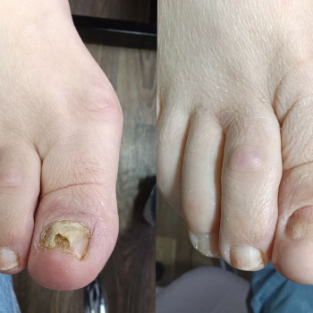 Оксана Дегтеренко, Чернигов Фото - 2