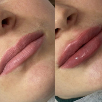 Shemet Art, Шостка Фото - 5