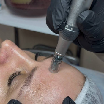 Омолодження шкіри
                    Косметолог Юлия Черкассы