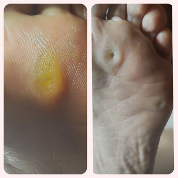 Ярослава Кречмаровська, Нетішин Фото - 9